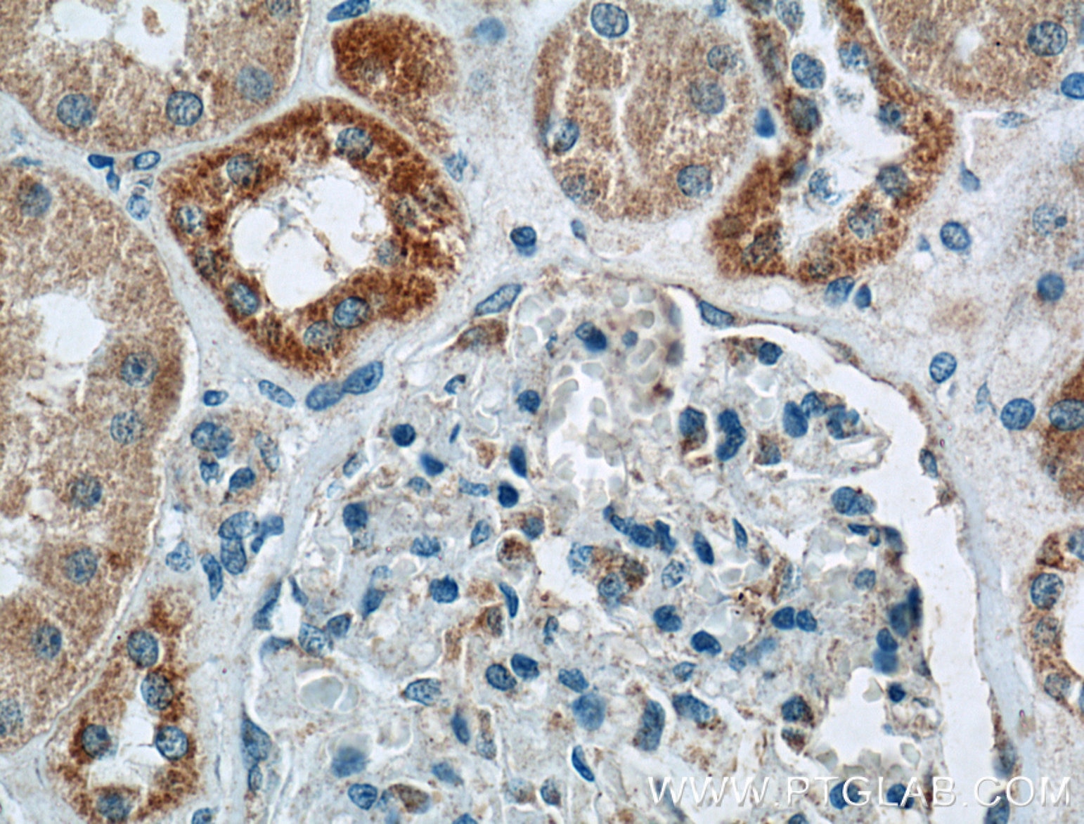 Immunohistochemistry (IHC) staining of human kidney tissue using BDKRB1 Polyclonal antibody (26672-1-AP)