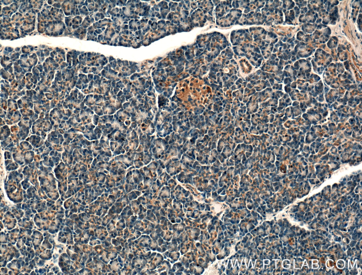 Immunohistochemistry (IHC) staining of human pancreas tissue using BDKRB1 Polyclonal antibody (26672-1-AP)