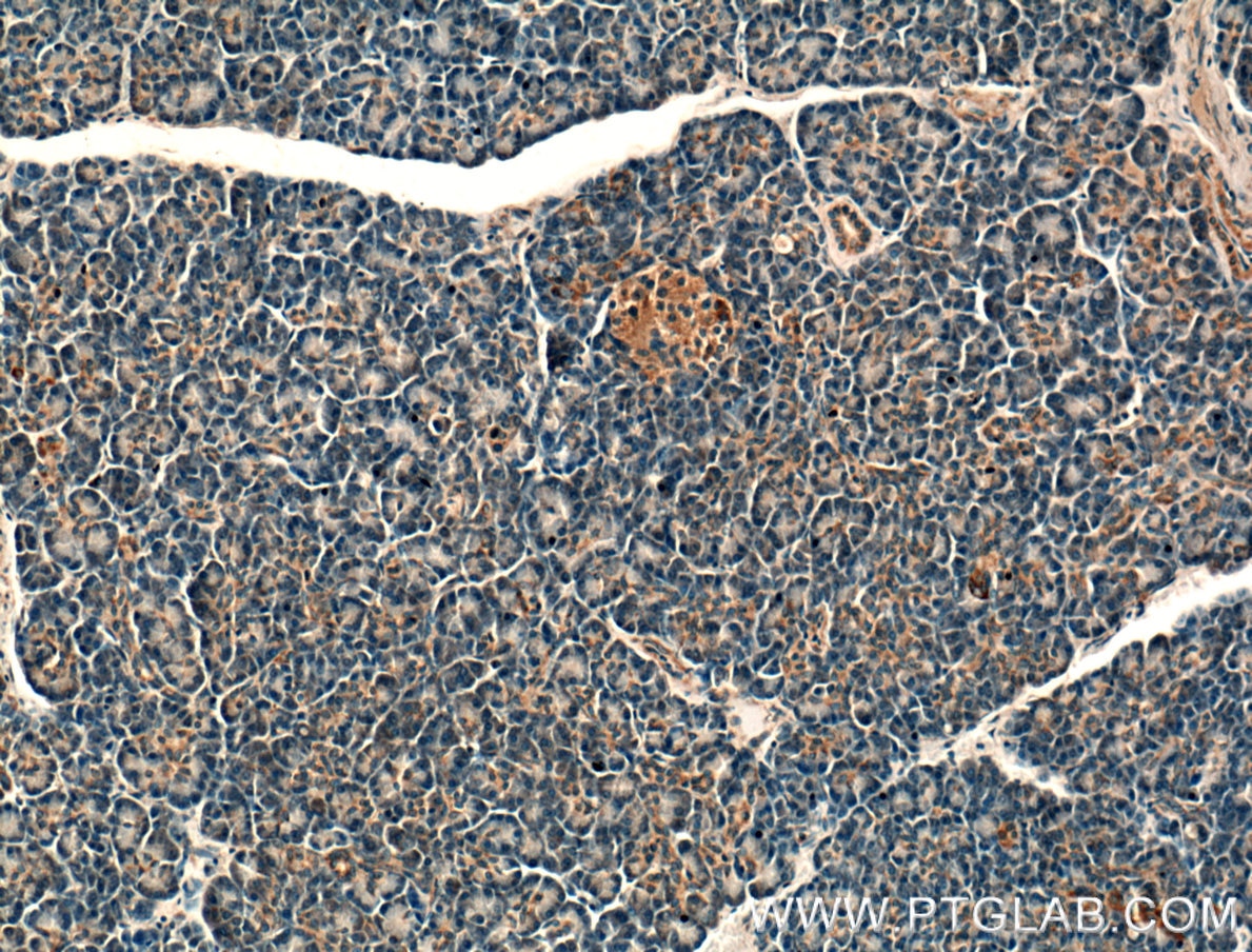 IHC staining of human pancreas using 26672-1-AP