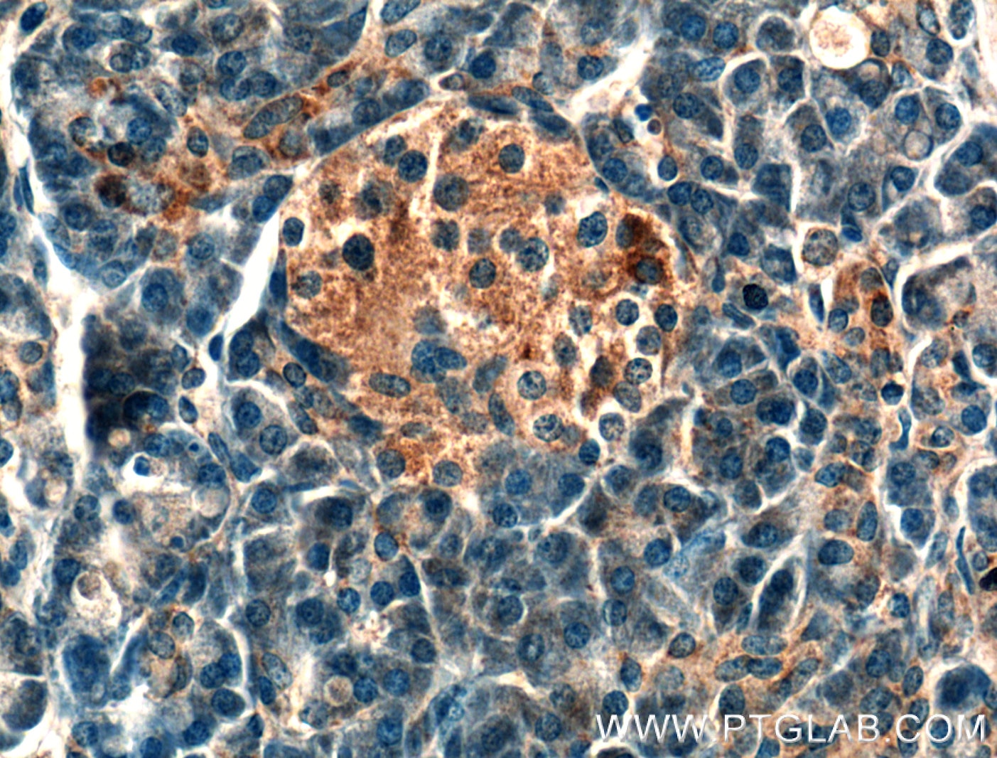 Immunohistochemistry (IHC) staining of human pancreas tissue using BDKRB1 Polyclonal antibody (26672-1-AP)