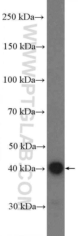 Western Blot (WB) analysis of HUVEC cells using BDKRB1 Polyclonal antibody (26672-1-AP)