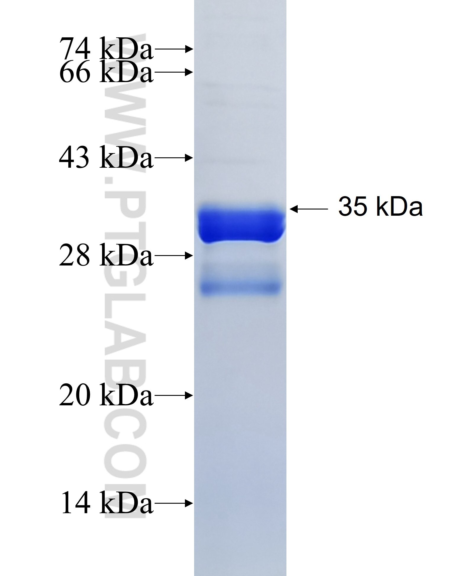 BDKRB2 fusion protein Ag12268 SDS-PAGE