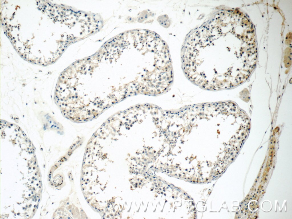 Immunohistochemistry (IHC) staining of human testis tissue using BDNF Polyclonal antibody (25699-1-AP)