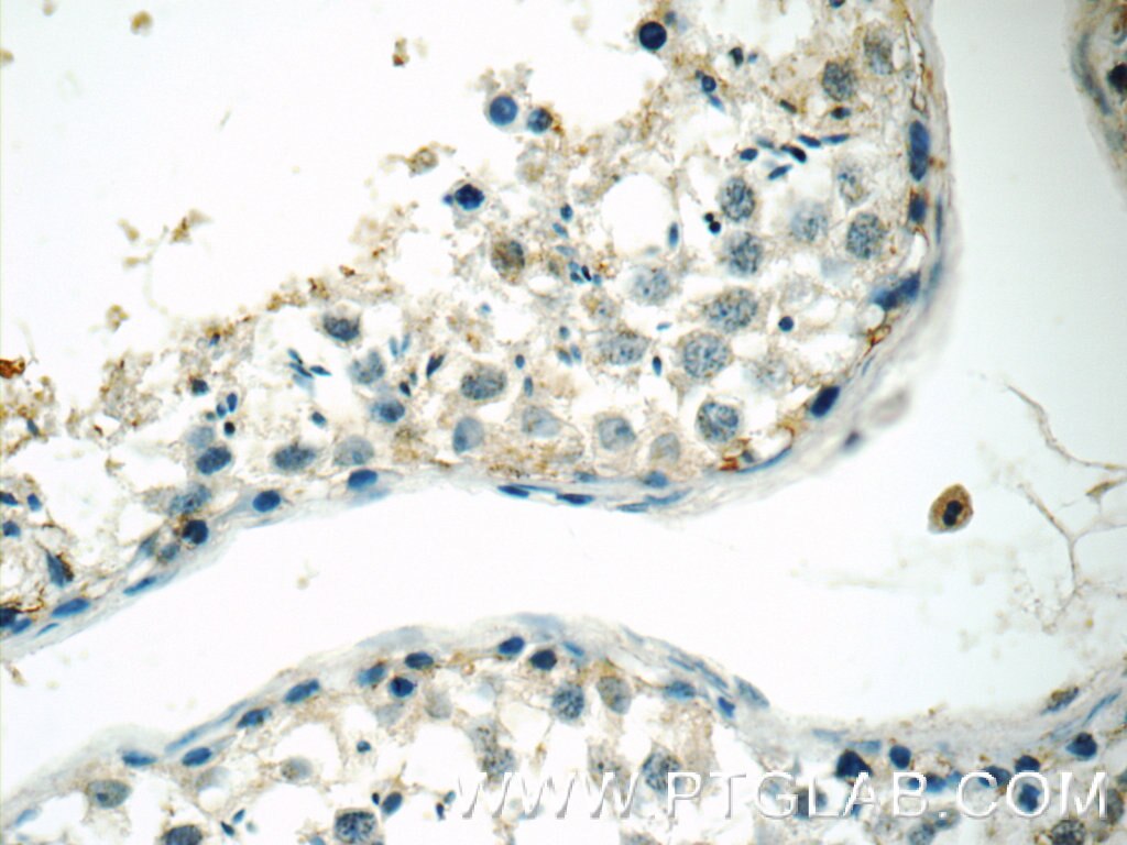 Immunohistochemistry (IHC) staining of human testis tissue using BDNF Polyclonal antibody (25699-1-AP)