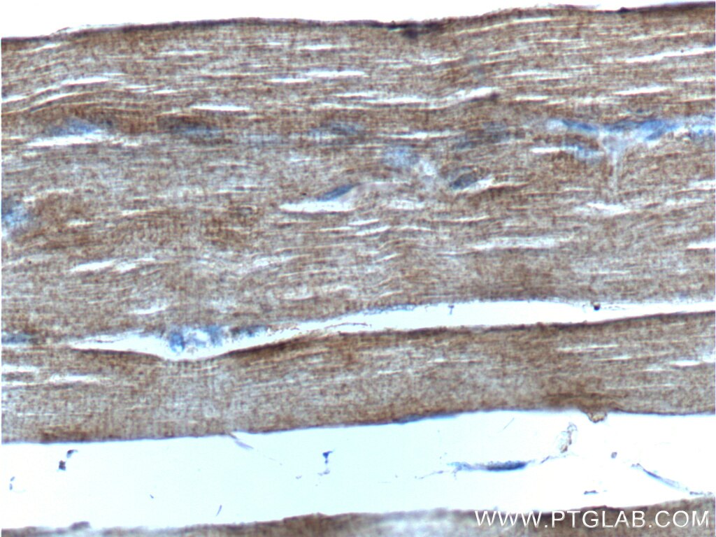 Immunohistochemistry (IHC) staining of human skeletal muscle tissue using BDNF Polyclonal antibody (25699-1-AP)