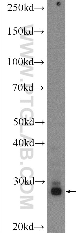 Western Blot (WB) analysis of fetal human brain tissue using BDNF Polyclonal antibody (25699-1-AP)