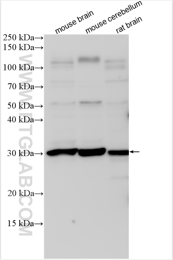 Western Blot (WB) analysis of various lysates using BDNF Polyclonal antibody (25699-1-AP)