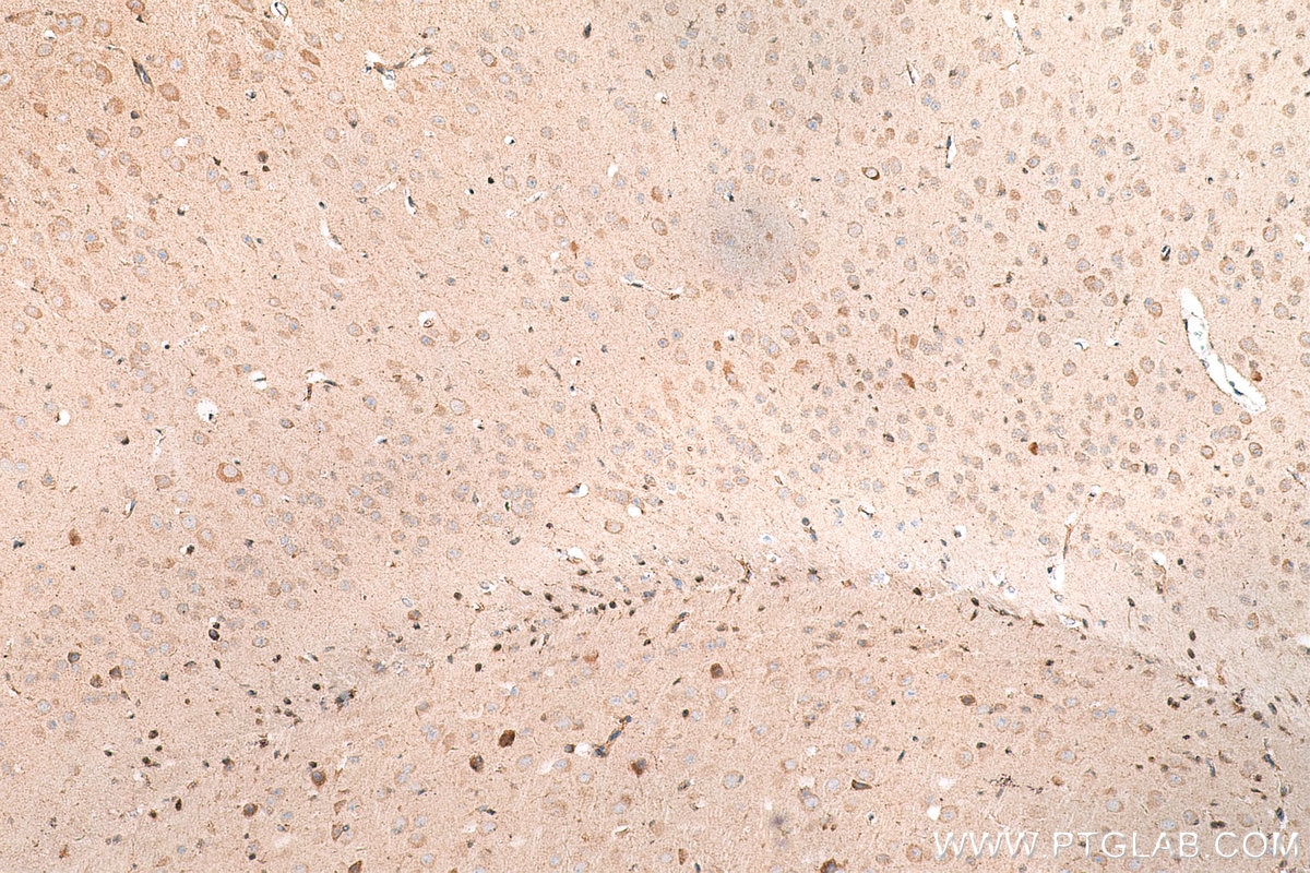 IHC staining of mouse brain using 28205-1-AP