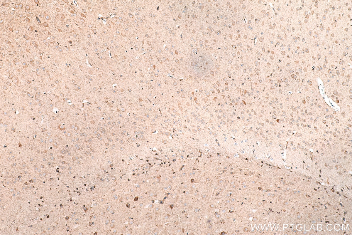 Immunohistochemistry (IHC) staining of mouse brain tissue using BDNF Polyclonal antibody (28205-1-AP)