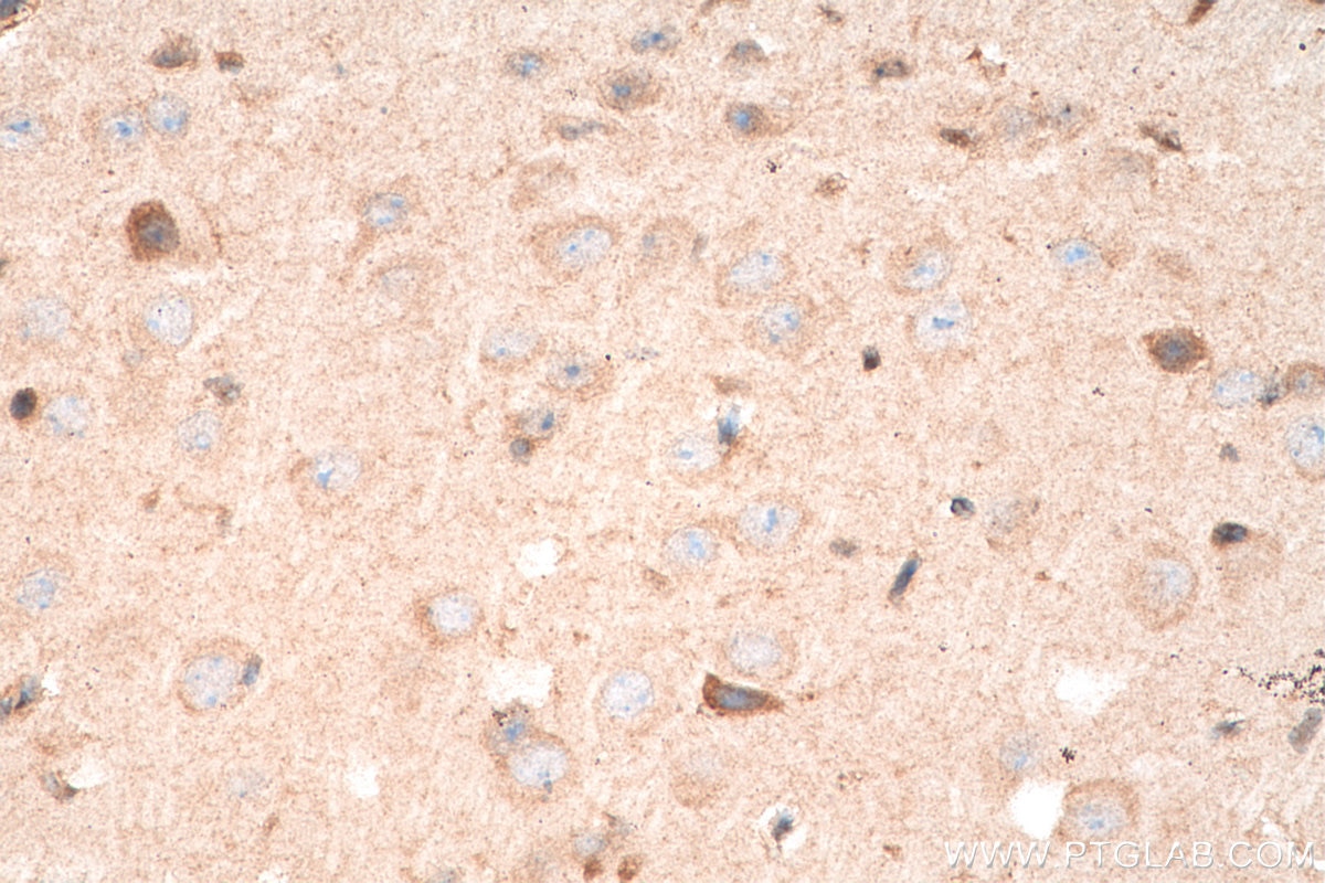 Immunohistochemistry (IHC) staining of mouse brain tissue using BDNF Polyclonal antibody (28205-1-AP)