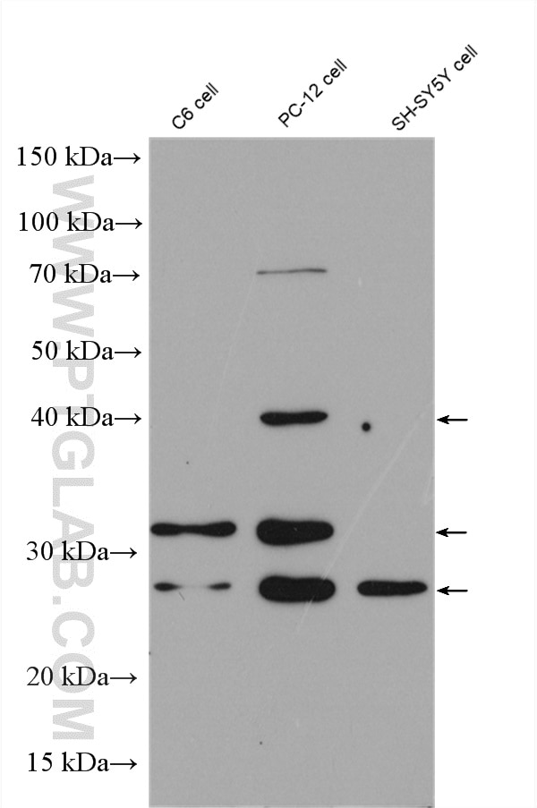 Western Blot (WB) analysis of various lysates using BDNF Polyclonal antibody (28205-1-AP)