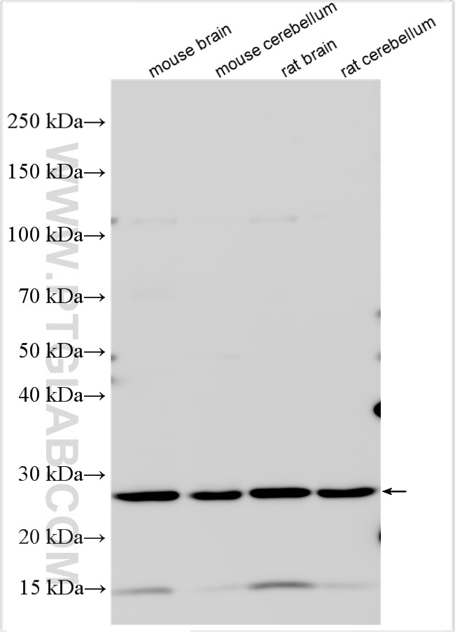 Western Blot (WB) analysis of various lysates using BDNF Polyclonal antibody (28205-1-AP)