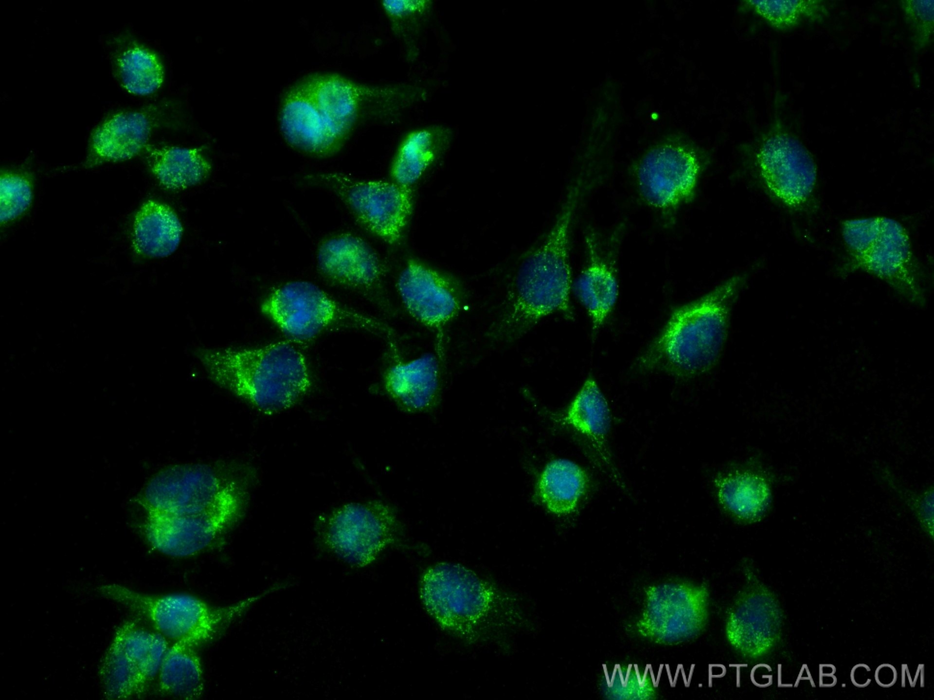 Immunofluorescence (IF) / fluorescent staining of U-251 cells using BDNF Monoclonal antibody (66292-1-Ig)