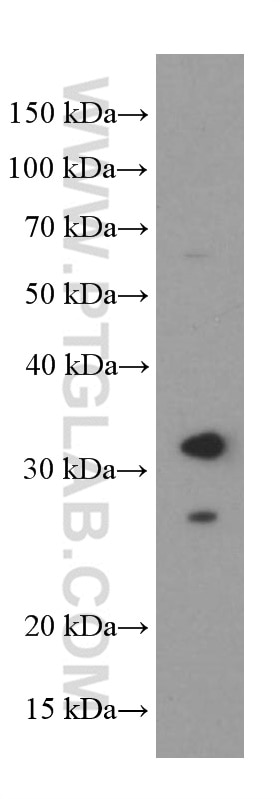 Western Blot (WB) analysis of fetal human brain tissue using BDNF Monoclonal antibody (66292-1-Ig)