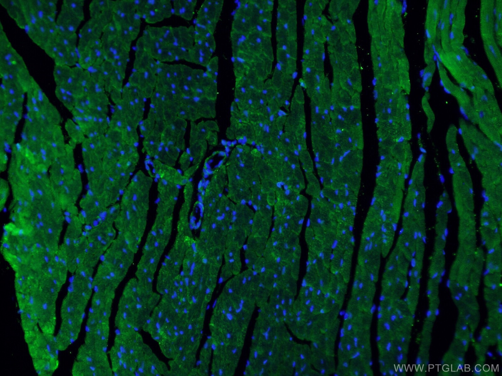 Immunofluorescence (IF) / fluorescent staining of mouse heart tissue using Beclin 1 Polyclonal antibody (11306-1-AP)