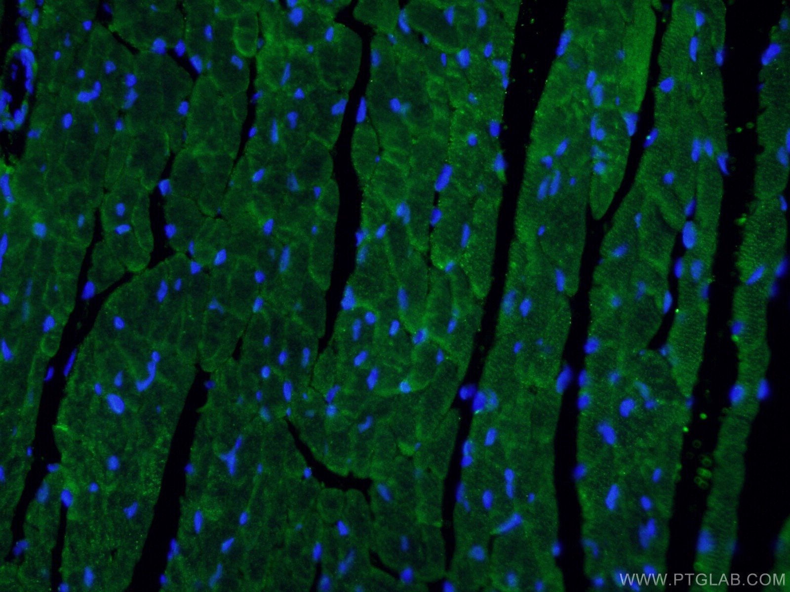 Immunofluorescence (IF) / fluorescent staining of mouse heart tissue using Beclin 1 Polyclonal antibody (11306-1-AP)