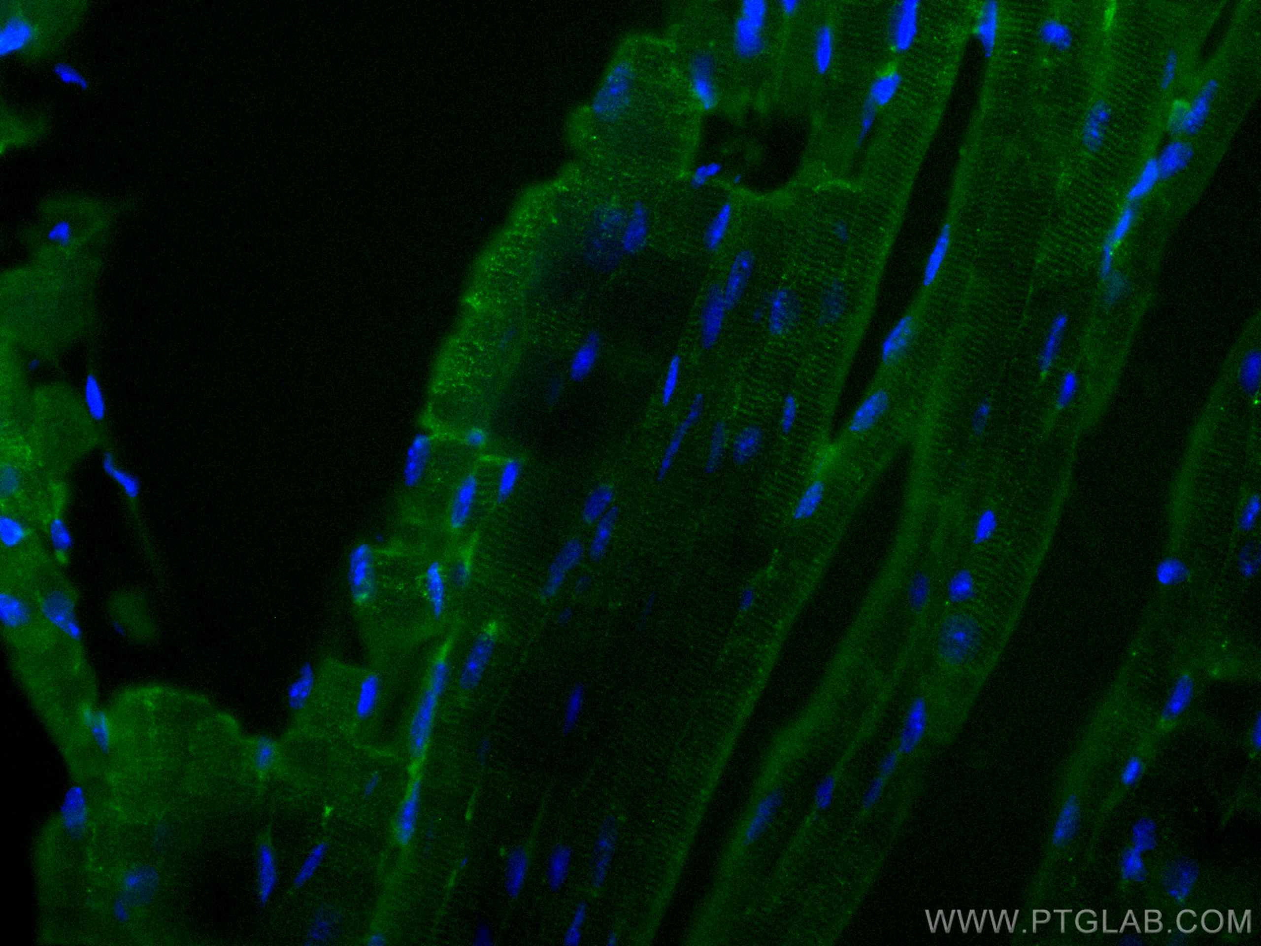 IF Staining of mouse heart using 11306-1-AP