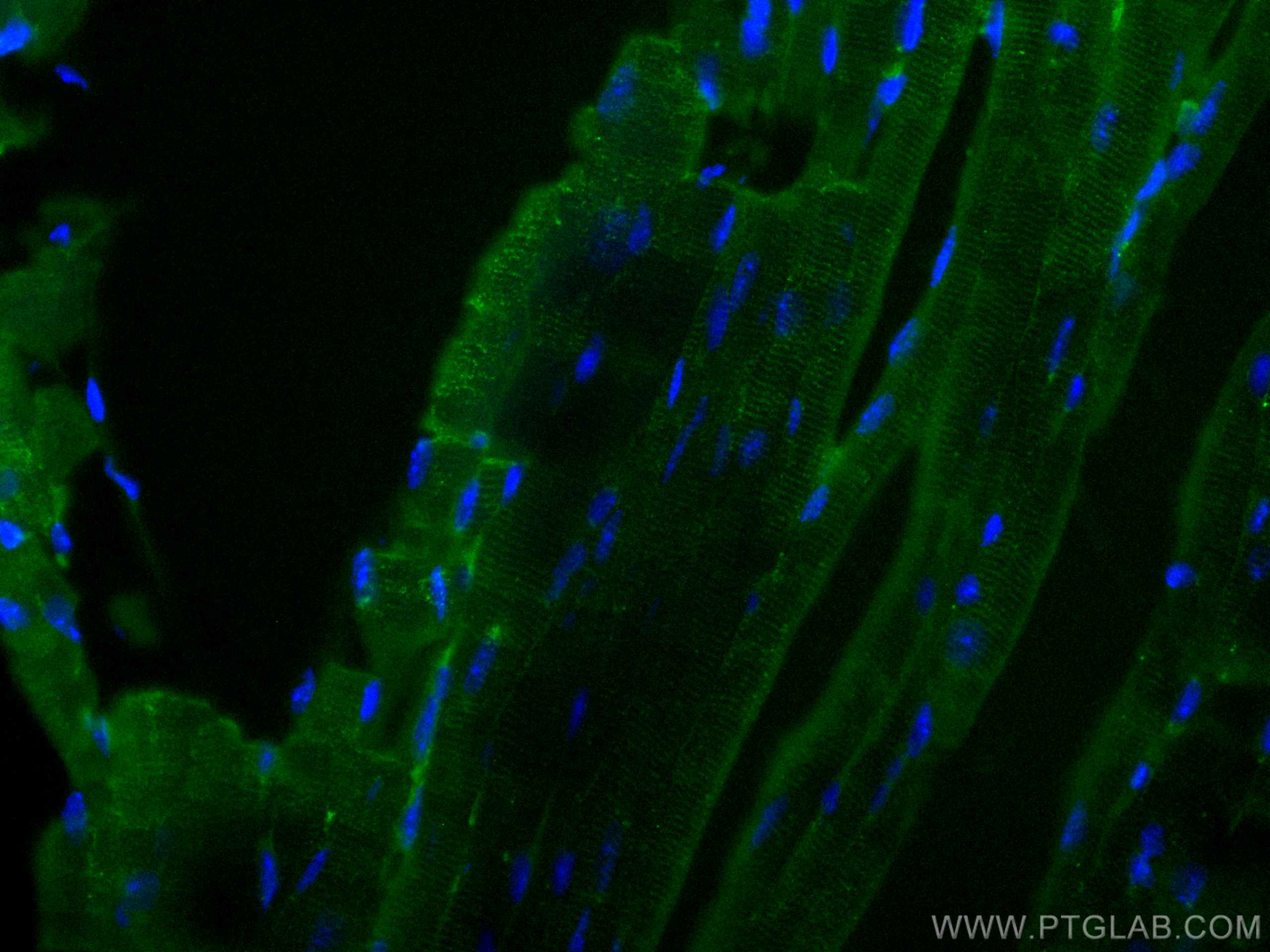 Immunofluorescence (IF) / fluorescent staining of mouse heart tissue using Beclin 1 Polyclonal antibody (11306-1-AP)