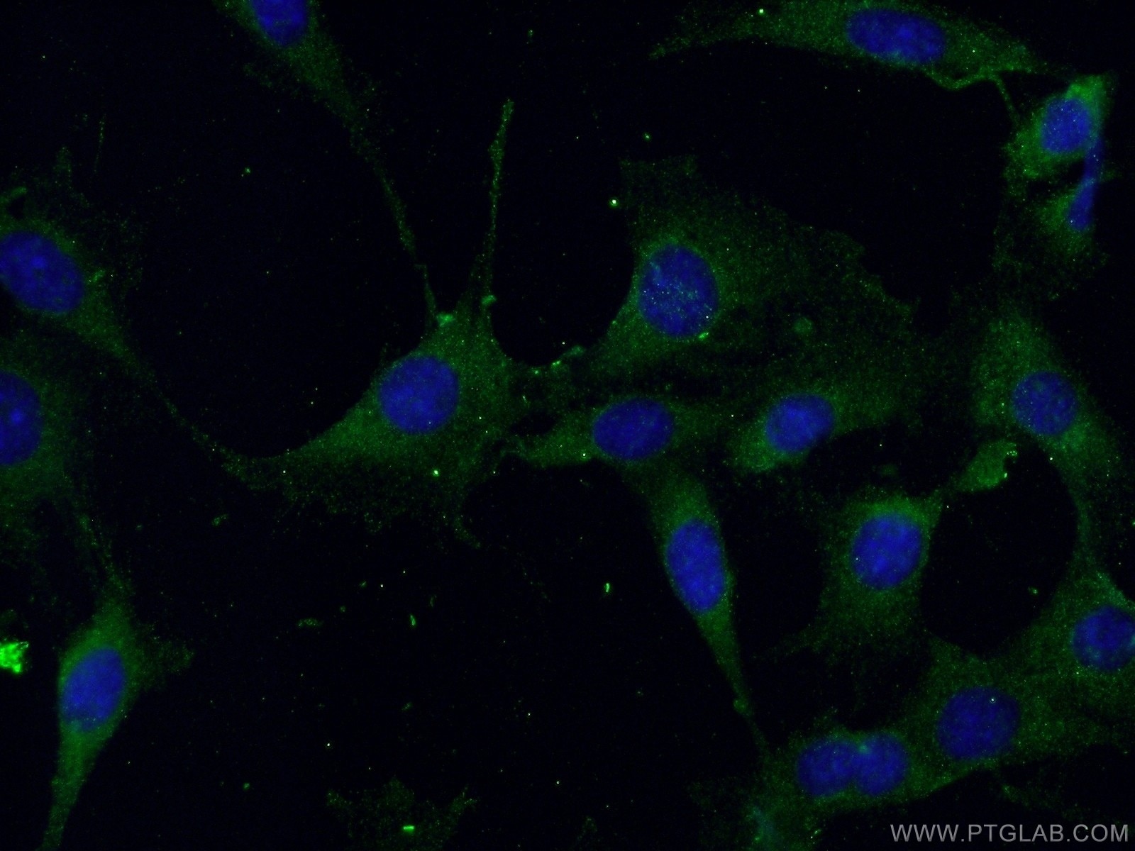 IF Staining of NIH/3T3 using 11306-1-AP