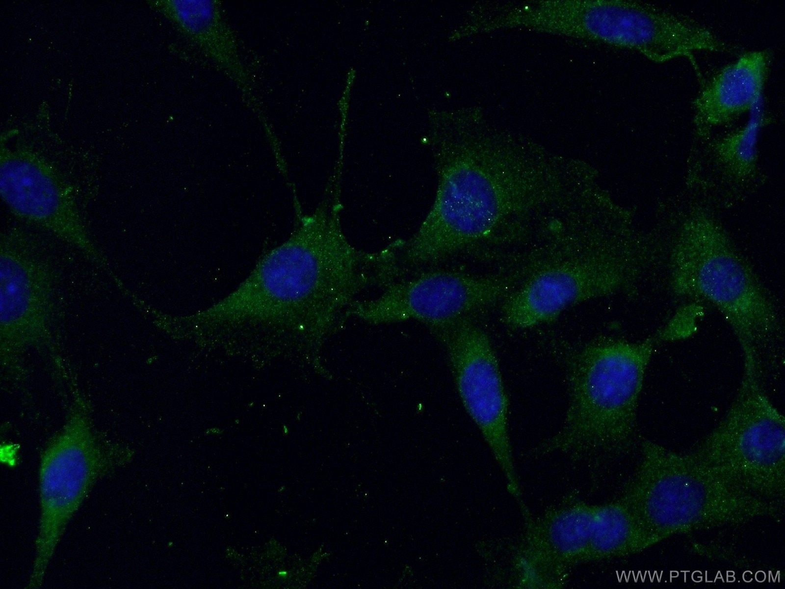 Beclin 1 Polyclonal antibody