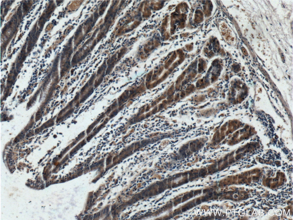 Immunohistochemistry (IHC) staining of human stomach tissue using Beclin 1 Polyclonal antibody (11306-1-AP)