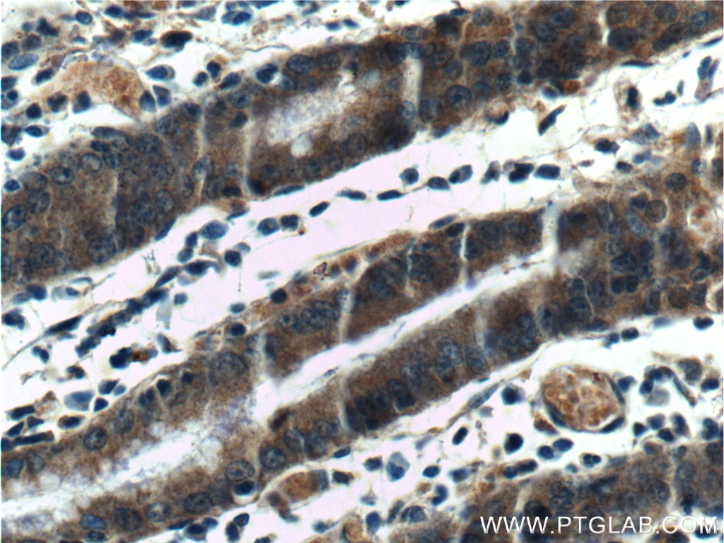 Immunohistochemistry (IHC) staining of human stomach tissue using Beclin 1 Polyclonal antibody (11306-1-AP)