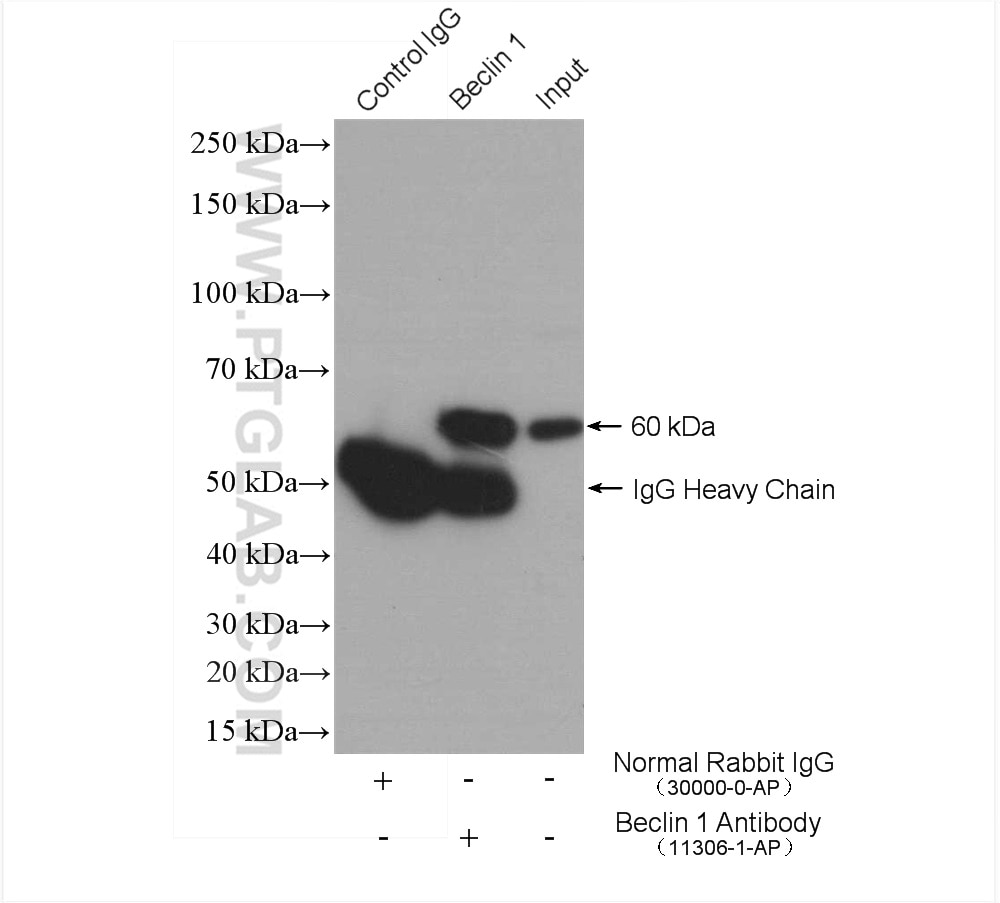 IP experiment of MDA-MB-453s using 11306-1-AP