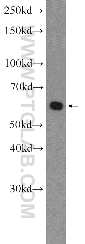 Beclin 1 Polyclonal antibody