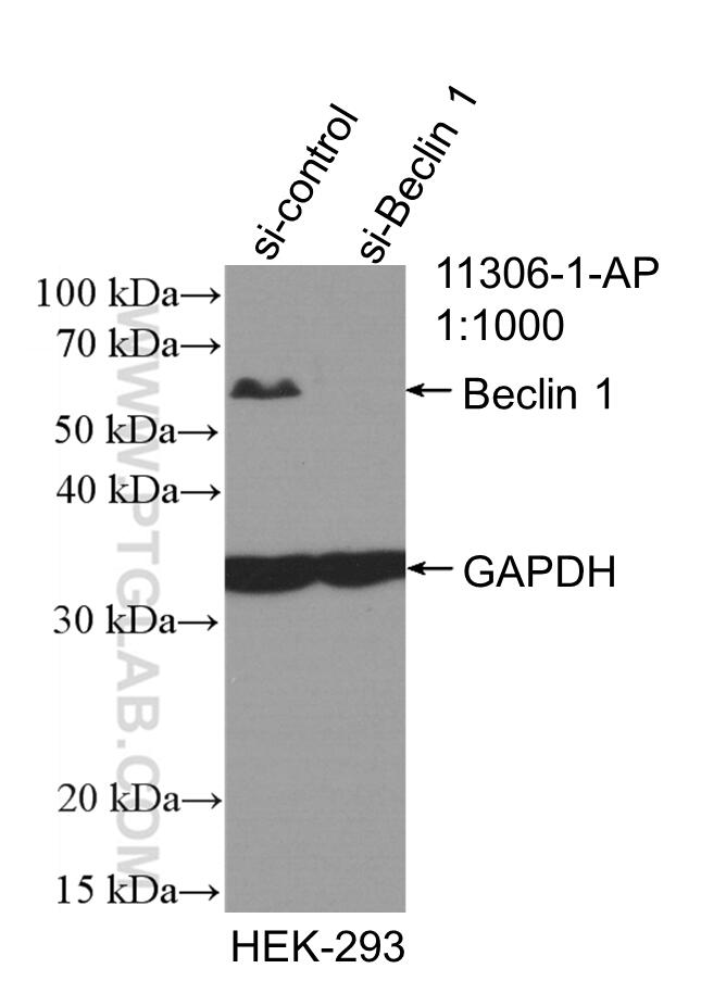 Western Blot (WB) analysis of HEK-293 cells using Beclin 1 Polyclonal antibody (11306-1-AP)