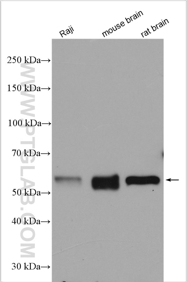 Western Blot (WB) analysis of various lysates using Beclin 1 Polyclonal antibody (11306-1-AP)