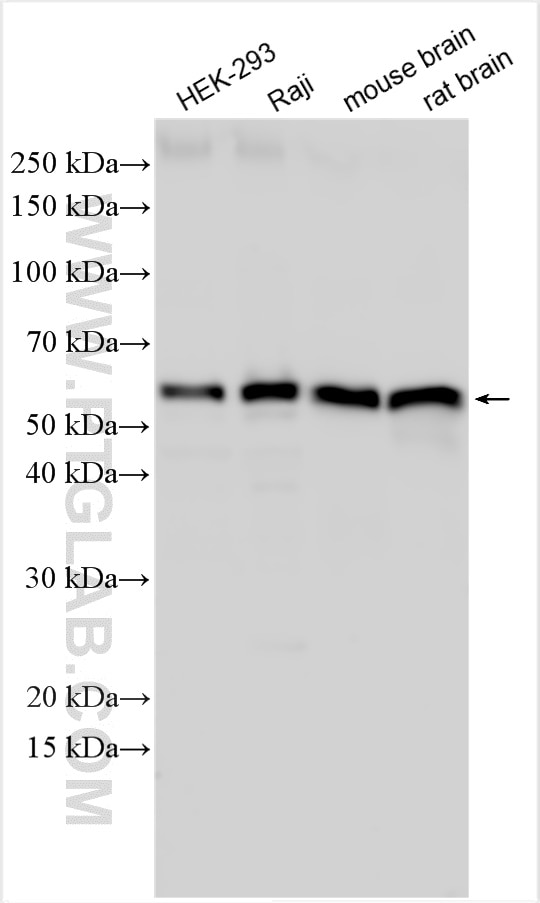 Western Blot (WB) analysis of various lysates using Beclin 1 Polyclonal antibody (11306-1-AP)