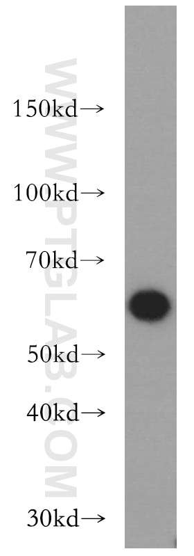 WB analysis of PC-3 using 11306-1-AP