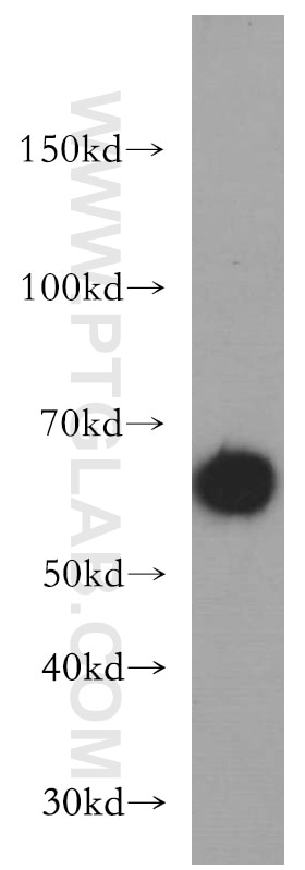 Western Blot (WB) analysis of A431 cells using Beclin 1 Polyclonal antibody (11306-1-AP)