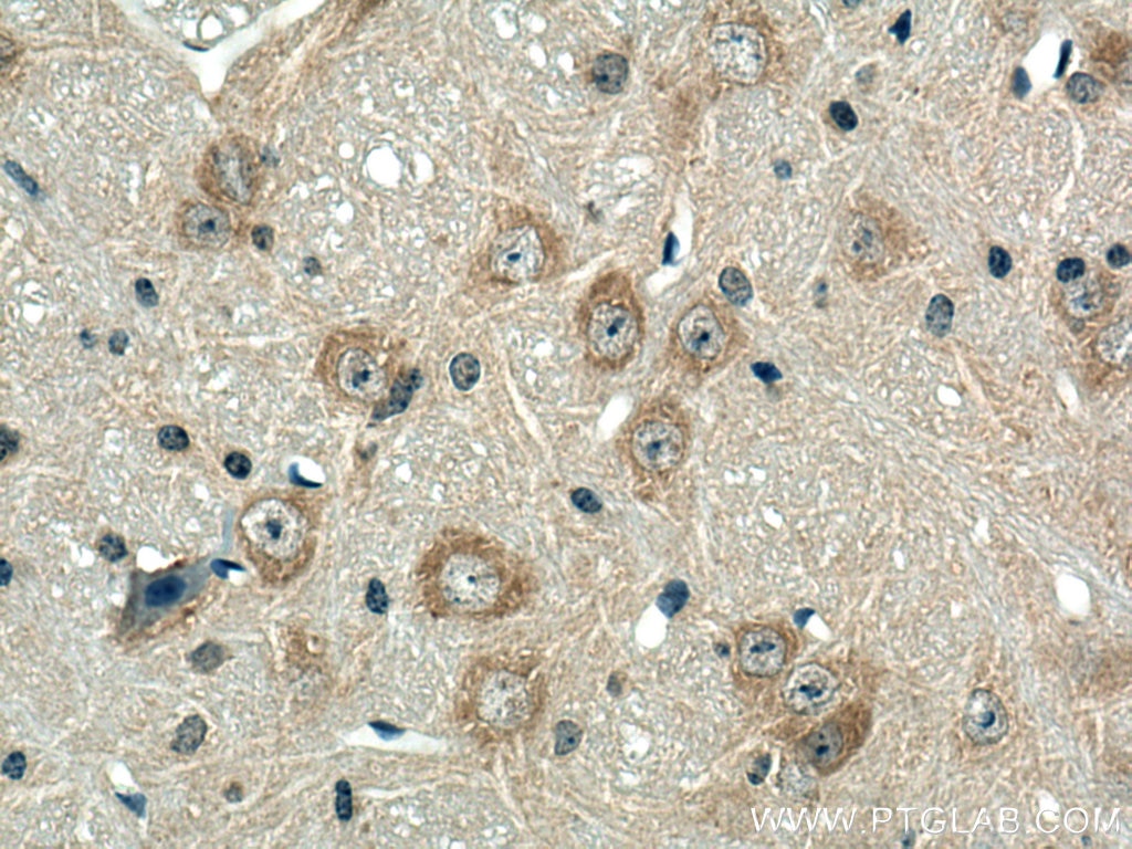 Immunohistochemistry (IHC) staining of mouse cerebellum tissue using BEGAIN Polyclonal antibody (14956-1-AP)