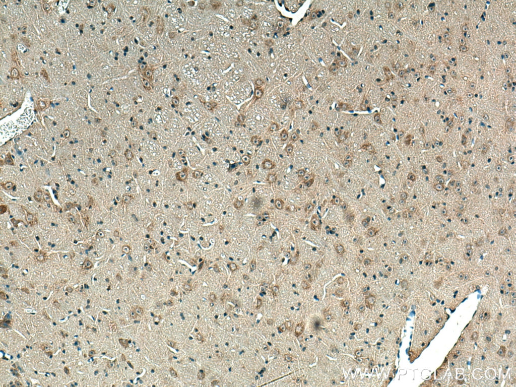 Immunohistochemistry (IHC) staining of mouse cerebellum tissue using BEGAIN Polyclonal antibody (14956-1-AP)
