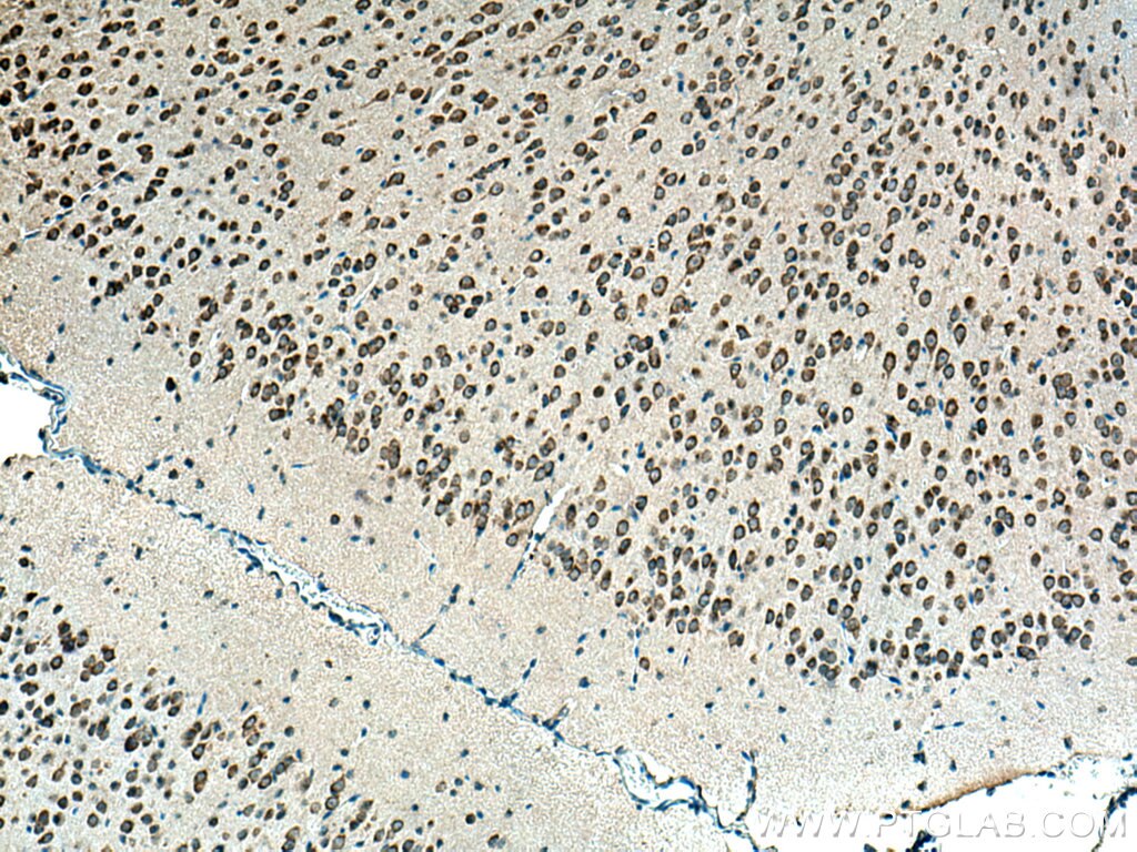 Immunohistochemistry (IHC) staining of mouse brain tissue using BEGAIN Polyclonal antibody (14956-1-AP)
