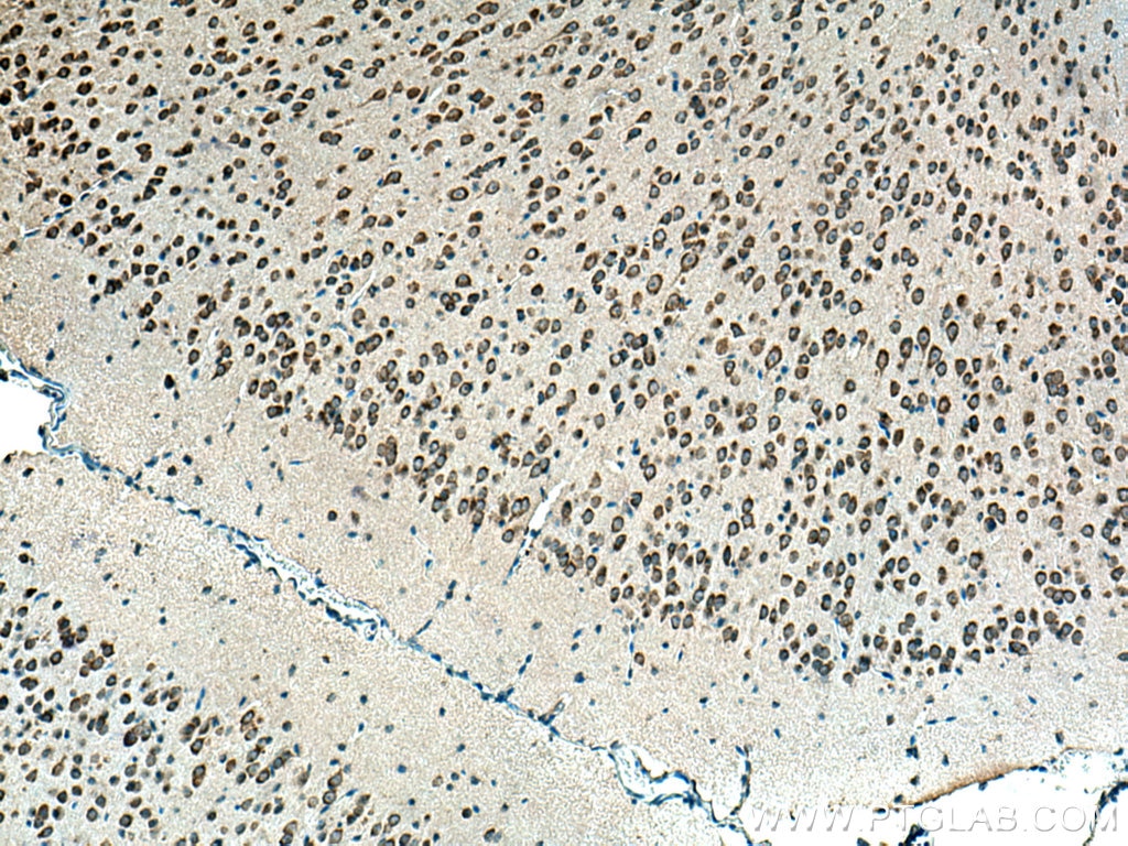 Immunohistochemistry (IHC) staining of mouse brain tissue using BEGAIN Polyclonal antibody (14956-1-AP)