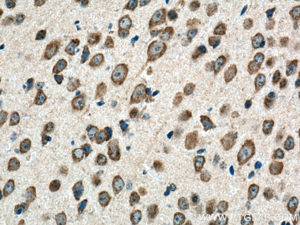 Immunohistochemistry (IHC) staining of mouse brain tissue using BEGAIN Polyclonal antibody (14956-1-AP)