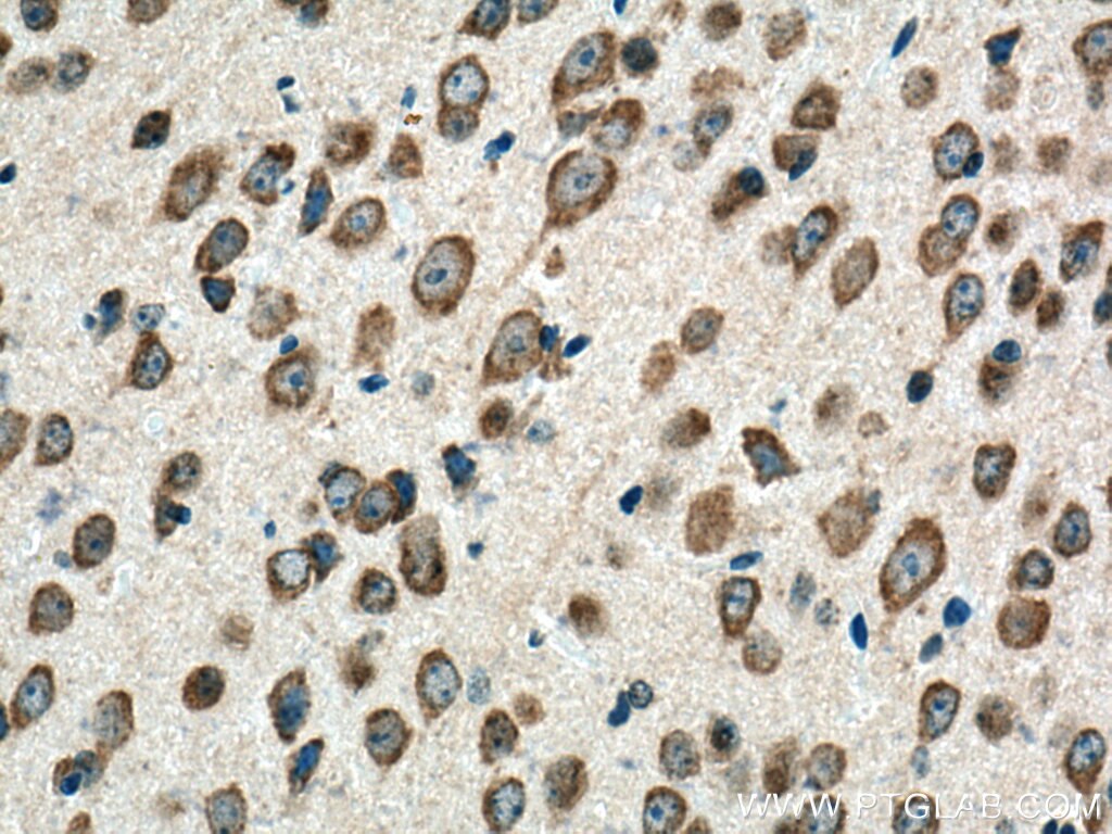 IHC staining of mouse brain using 14956-1-AP