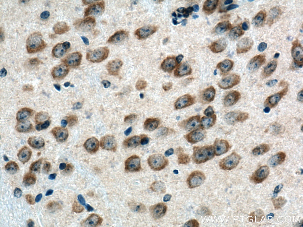 Immunohistochemistry (IHC) staining of mouse brain tissue using BEGAIN Polyclonal antibody (14956-1-AP)