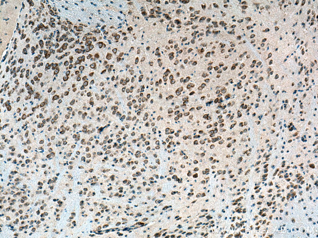 Immunohistochemistry (IHC) staining of mouse brain tissue using BEGAIN Polyclonal antibody (14956-1-AP)