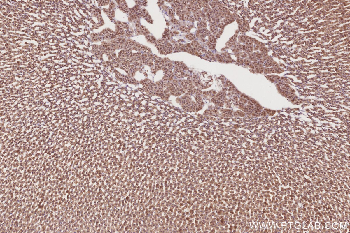 Immunohistochemistry (IHC) staining of rat adrenal gland tissue using BEGAIN Polyclonal antibody (14956-1-AP)