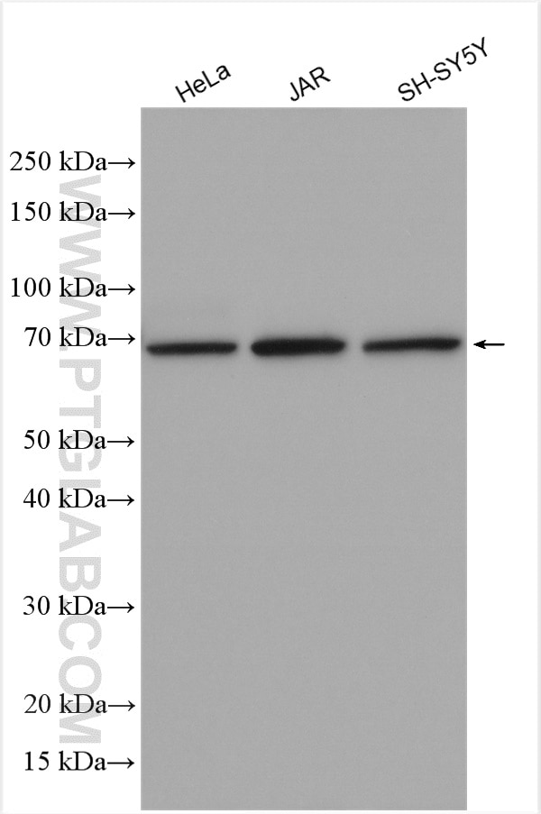 Western Blot (WB) analysis of various lysates using BEGAIN Polyclonal antibody (14956-1-AP)