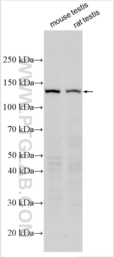 WB analysis using 24958-1-AP (same clone as 24958-1-PBS) Western Blot (WB) analysis of various lysates using BEND2 Polyclonal antibody (24958-1-AP)