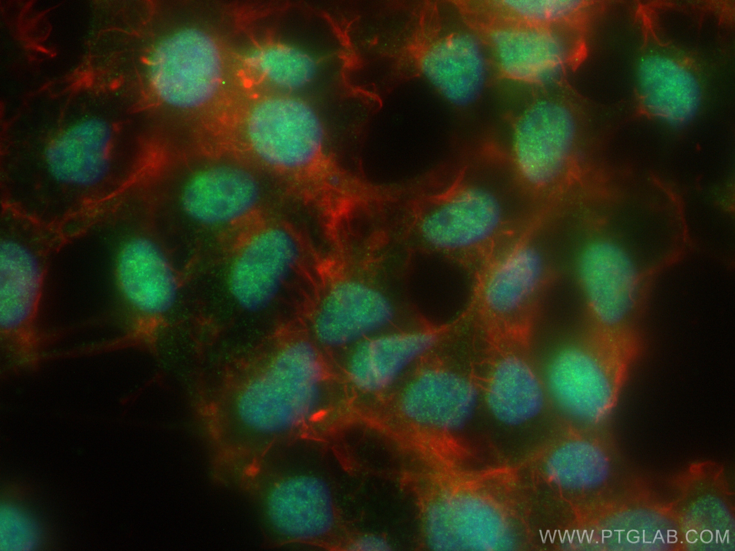 Immunofluorescence (IF) / fluorescent staining of HEK-293 cells using BEND3 Polyclonal antibody (23101-1-AP)