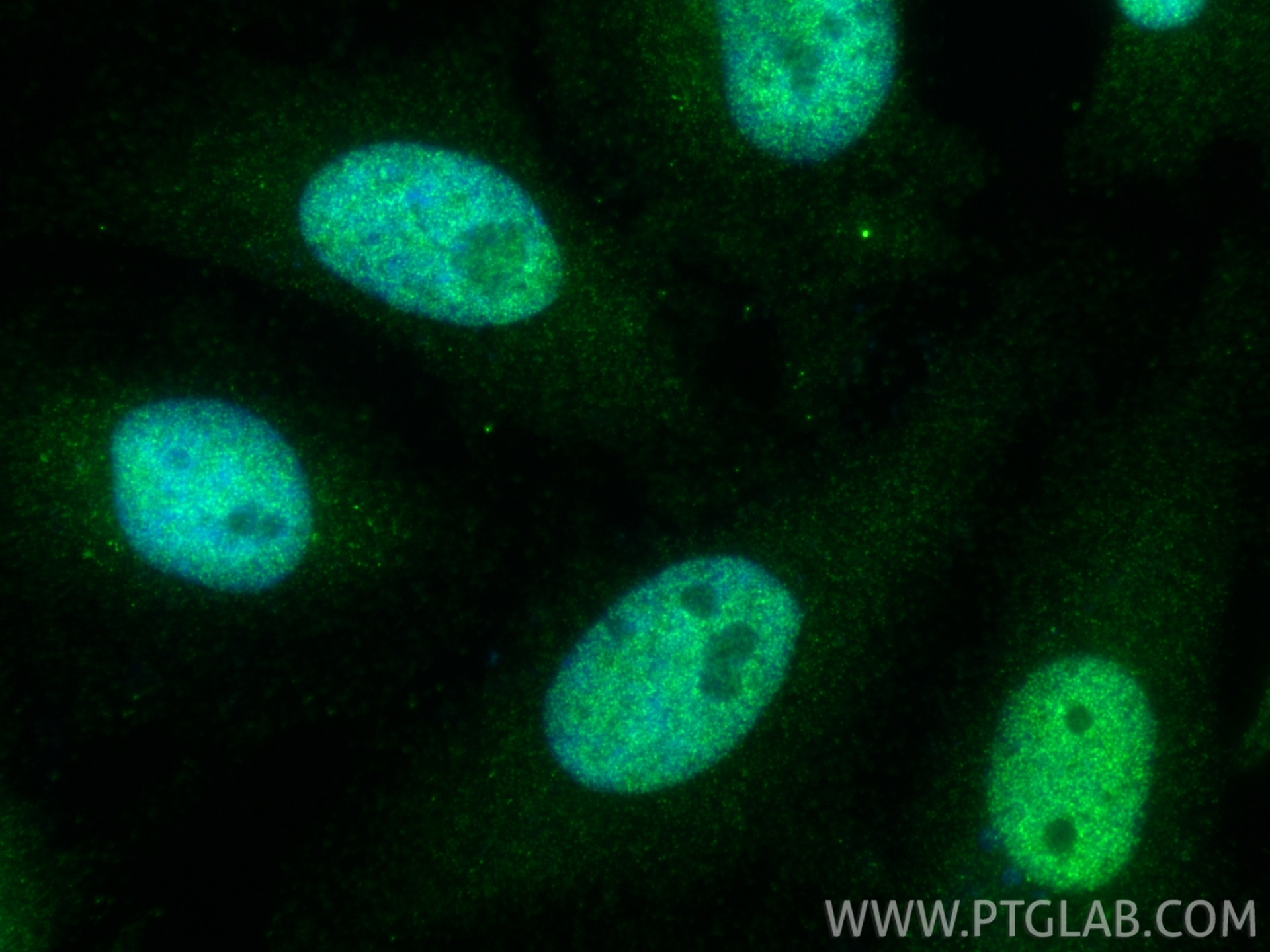 Immunofluorescence (IF) / fluorescent staining of HeLa cells using BEND3 Polyclonal antibody (23101-1-AP)