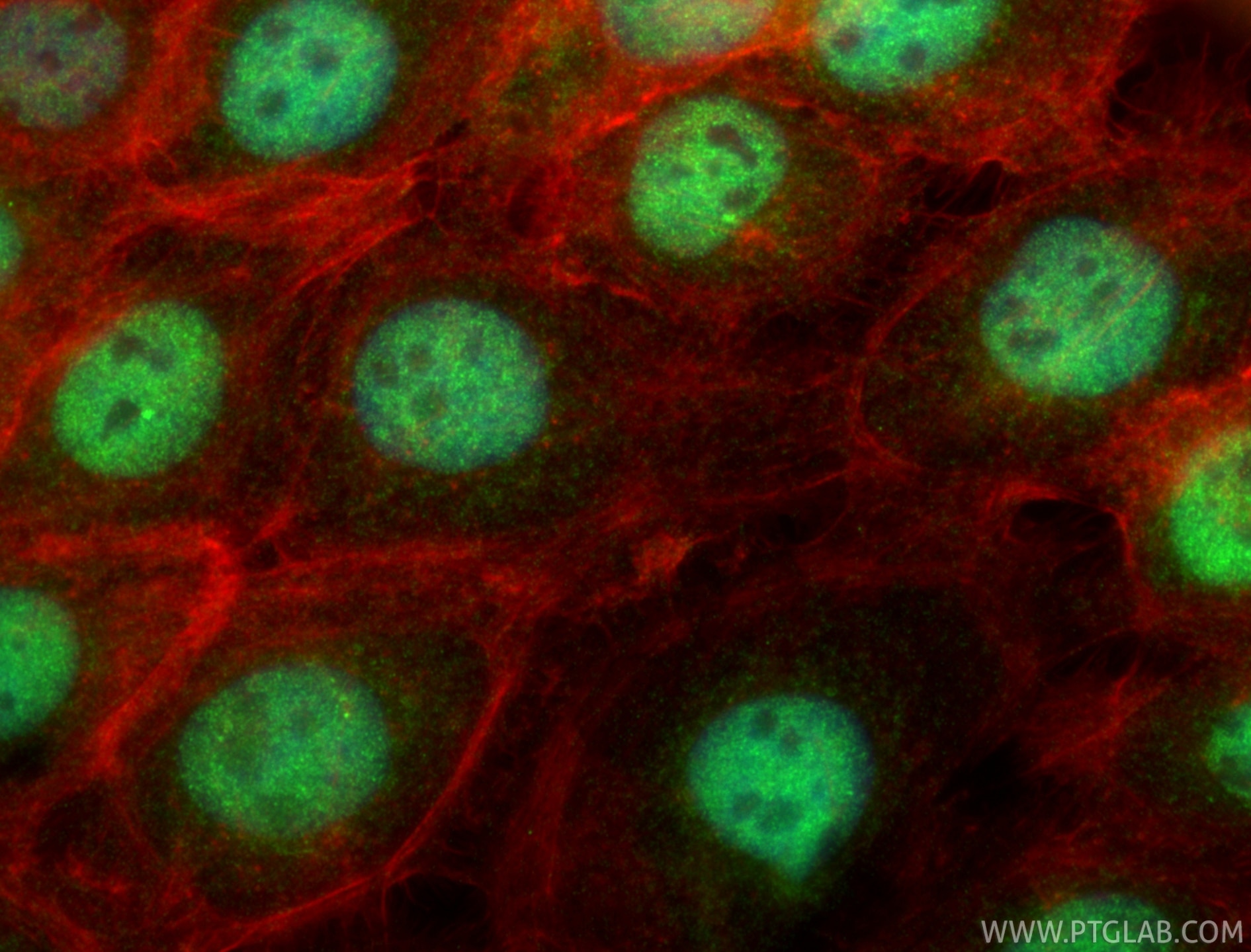 Immunofluorescence (IF) / fluorescent staining of A431 cells using BEND3 Polyclonal antibody (23101-1-AP)