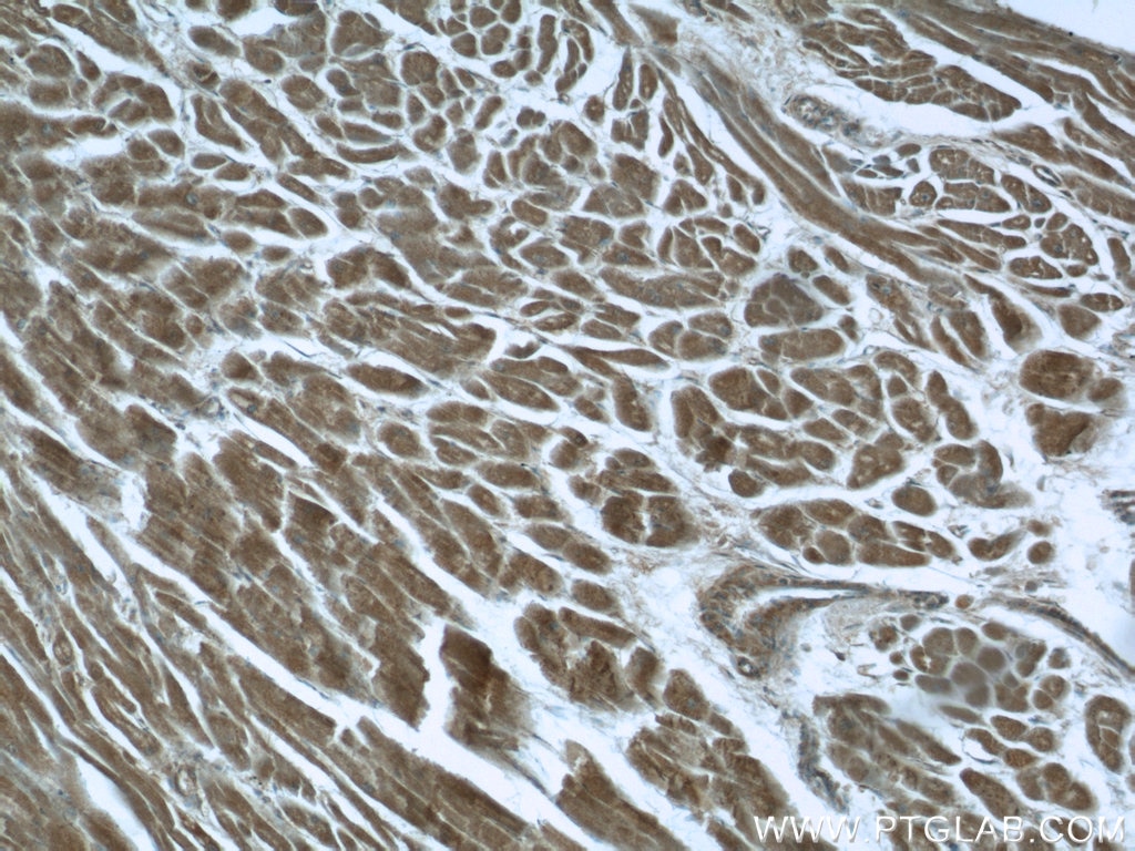 Immunohistochemistry (IHC) staining of human heart tissue using BEND4 Polyclonal antibody (24711-1-AP)