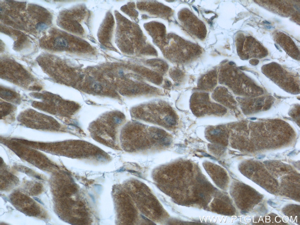 Immunohistochemistry (IHC) staining of human heart tissue using BEND4 Polyclonal antibody (24711-1-AP)