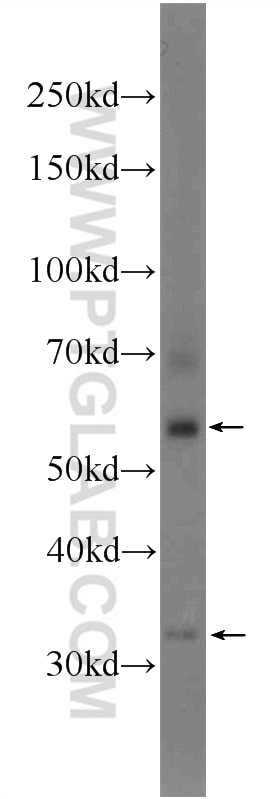 Western Blot (WB) analysis of mouse testis tissue using BEND4 Polyclonal antibody (24711-1-AP)